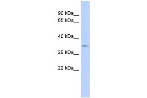 WB Suggested Anti-TRIM34 Antibody Titration:  0. (TRIM34 anticorps  (N-Term))