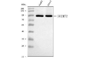Western blot analysis of LIN41/TRIM71 using anti-LIN41/TRIM71 antibody (ABIN7602565).