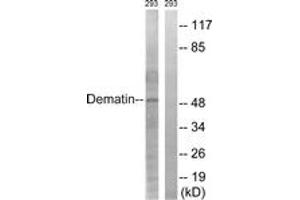 Western Blotting (WB) image for anti-erythrocyte Membrane Protein Band 4.9 (Dematin) (EPB49) (AA 356-405) antibody (ABIN2888822) (Dematin anticorps  (AA 356-405))