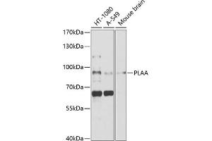 Western blot analysis of extracts of various cell lines, using PLAA antibody (ABIN1682194, ABIN3018787, ABIN3018788 and ABIN6220577) at 1:1000 dilution. (PLAA anticorps  (AA 536-795))