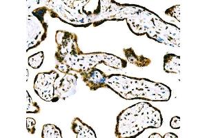 IHC analysis of CBX2 using anti-CBX2 antibody (ABIN7599466). (CBX2 anticorps  (AA 1-532))
