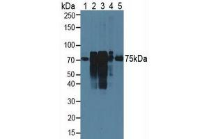 Western blot analysis of (1) Rat Serum, (2) Rat Lung Tissue, (3) Rat Placenta Tissue, (4) Rat Uterus Tissue and (5) Human HeLa cells. (Cortactin anticorps  (AA 1-509))