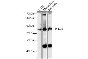 Western blot analysis of extracts of various cell lines, using PRKCB antibody (ABIN6128463, ABIN6146200, ABIN6146202 and ABIN6221544) at 1:3000 dilution. (PKC beta anticorps  (AA 220-340))