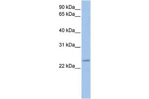 WB Suggested Anti-FKBP3  Antibody Titration: 0.