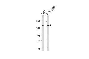 All lanes : Anti-ABCC12 Antibody (Center) at 1:2000 dilution Lane 1: T47D whole cell lysate Lane 2: R whole cell lysate Lysates/proteins at 20 μg per lane. (ABCC12 anticorps  (AA 723-752))
