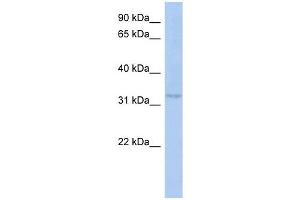 C10ORF96 antibody used at 1 ug/ml to detect target protein. (C10ORF96 anticorps  (Middle Region))
