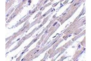 Immunohistochemistry of Bcl-rambo in human heart tissue with Bcl-rambo antibody at 10 μg/ml.