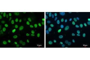 ICC/IF Image Rb antibody detects Rb protein at nucleus by immunofluorescent analysis. (Retinoblastoma 1 anticorps  (C-Term))