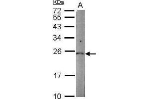 WB Image Sample (50 ug of whole cell lysate) A: mouse kidney 12% SDS PAGE antibody diluted at 1:1000 (PGPEP1 anticorps)