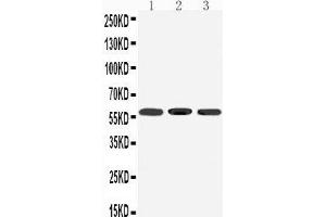 Western Blotting (WB) image for anti-Dopamine Receptor D5 (DRD5) (AA 388-407), (C-Term) antibody (ABIN3042836) (DRD5 anticorps  (C-Term))