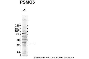 Sample Type: 4. (PSMC5 anticorps  (C-Term))