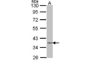 WB Image Sample (30 ug of whole cell lysate) A: A431 , 10% SDS PAGE antibody diluted at 1:1000 (LEFTY2 anticorps)