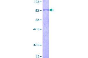 Image no. 1 for Embryonal Fyn-Associated Substrate (EFS) (AA 1-468) protein (GST tag) (ABIN1352417)