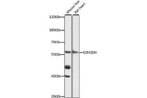 Western blot analysis of extracts of various cell lines, using D2HGDH antibody (ABIN7266669) at 1:1000 dilution.