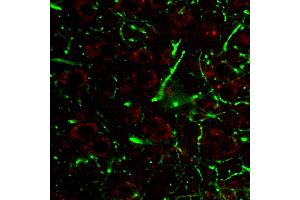 Immunohistochemistry staining of CD107a (red) in tissue sections of murine brain expressing GFP in some of its neurons (green).