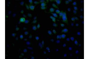 Immunofluorescence staining of HepG2 cells with ABIN7155555 at 1:100, counter-stained with DAPI.