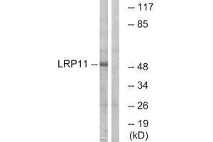 Western blot analysis of extracts from Jurkat cells, using LRP11 antibody. (LRP11 anticorps)