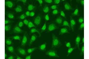 Immunofluorescence analysis of HeLa cells using LIG3 antibody. (LIG3 anticorps)
