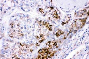 IHC analysis of CBS using anti-CBS antibody (ABIN3043747). (CBS anticorps  (AA 331-551))