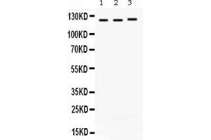 Western blot analysis of CRM1 expression in rat cardiac muscle extract ( Lane 1), mouse brain extract ( Lane 2) and A549 whole cell lysates ( Lane 3). (XPO1 anticorps  (AA 966-1071))