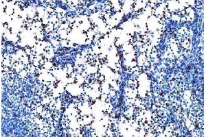 IHC analysis of PU.
