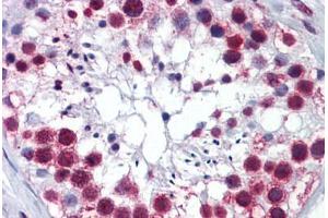 anti-Ribosomal L24 Domain Containing 1 (RSL24D1) (AA 1-151) antibody