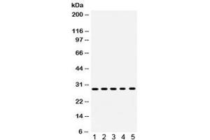 Western blot testing of human 1) MCF7, 2) MM231, 3) MM453, 4) SKOV and 5) HeLa lysate with XBP1 antibody. (XBP1 anticorps)