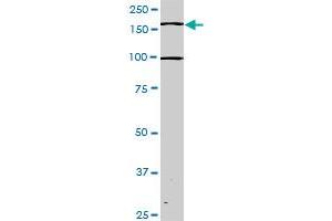 Western Blotting (WB) image for anti-TEK Tyrosine Kinase, Endothelial (TEK) (AA 66-185) antibody (ABIN793004) (TEK anticorps  (AA 66-185))