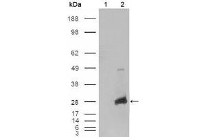 Western Blot showing CRYAB antibody used against HEK293T cells transfected with the pCMV6-ENTRY control (1) and pCMV6-ENTRY CRYAB cDNA (2). (CRYAB anticorps  (AA 1-175))