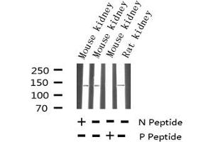 Western blot analysis of Phospho-eNOS (Thr494) expression in various lysates