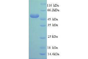 SDS-PAGE (SDS) image for Ribosomal Protein L14 (RPL14) (AA 2-214), (partial) protein (GST tag) (ABIN5712063)