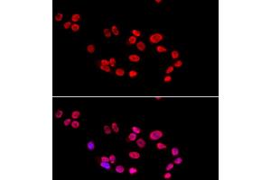 Immunofluorescence analysis of HeLa cells using XRCC5 antibody. (XRCC5 anticorps)
