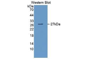 Western blot analysis of the recombinant protein. (LPO anticorps  (AA 351-589))