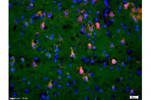 Formalin-fixed and paraffin-embedded rat brain labeled with Anti-Phospho-TAK1(Thr184/187) Polyclonal Antibody, Unconjugated (ABIN746348) 1:200, overnight at 4°C, The secondary antibody was Goat Anti-Rabbit IgG, Cy3 conjugated used at 1:200 dilution for 40 minutes at 37°C. (TR4 anticorps  (pThr184, pThr187))