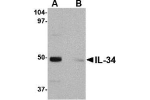 Western Blotting (WB) image for anti-Interleukin 34 (IL34) (Middle Region) antibody (ABIN1030960) (IL-34 anticorps  (Middle Region))