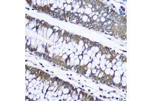 Immunohistochemistry of paraffin-embedded human placenta using Ubiquitin Rabbit pAb (ABIN3022990, ABIN3022991, ABIN3022992 and ABIN6219334) at dilution of 1:100 (40x lens). (Ubiquitin B anticorps  (AA 1-76))