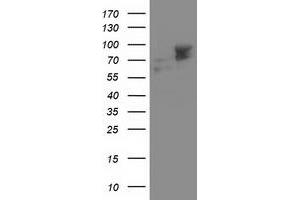 Western Blotting (WB) image for anti-Aldehyde Dehydrogenase 3 Family, Member A2 (ALDH3A2) antibody (ABIN1496596) (ALDH3A2 anticorps)