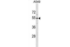 Western Blotting (WB) image for anti-Pseudouridylate Synthase 10 (PUS10) antibody (ABIN5020829) (PUS10 anticorps)
