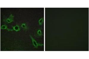 Immunofluorescence analysis of COS7 cells, using HTR7 Antibody. (HTR7 anticorps  (AA 391-440))