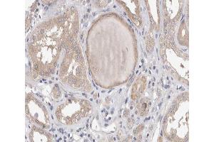 ABIN6267538 at 1/200 staining human kidney tissue sections by IHC-P. (PLA2G4A anticorps  (pSer505))