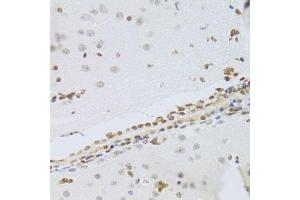Immunohistochemistry of paraffin-embedded mouse brain using HMGB1 Antibody. (HMGB1 anticorps  (AA 100-200))