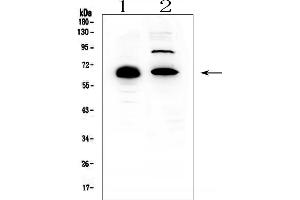 Western blot analysis of CCDC36 using anti-CCDC36 antibody (ABIN6719645). (CCDC36 anticorps  (AA 172-472))