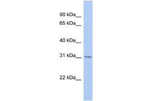 WB Suggested Anti-TSPAN12 Antibody Titration:  0. (TSPAN12 anticorps  (Middle Region))