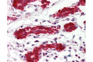 Anti-PDCD4 antibody IHC of human breast. (PDCD4 anticorps  (AA 1-469))