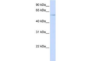 WB Suggested Anti-RIPK3 Antibody Titration:  0. (RIPK3 anticorps  (N-Term))