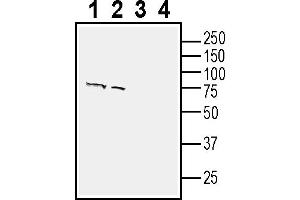 Western blot analysis of human SH-SY5Y neuroblastoma cell line lysate (lanes 1 and 3) and human  retinal pigmental epithelia cell line lysate (lanes 2 and 4):1-2.