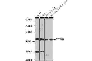 Western blot analysis of extracts of various cell lines, using GTF2H4 antibody  at 1:1000 dilution. (GTF2H4 anticorps  (AA 1-300))