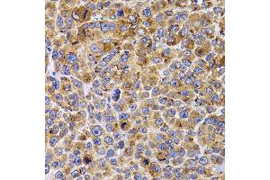 Immunohistochemistry of paraffin-embedded mouse cancer using UBE2R2 antibody at dilution of 1:100 (x400 lens). (UBE2R2 anticorps)