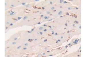 Detection of FGB in Mouse Heart Tissue using Polyclonal Antibody to Fibrinogen Beta Chain (FGB)