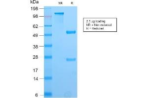SDS-PAGE Analysis Purified PAX8 Recombinant Rabbit Monoclonal Antibody (PAX8/2774R).